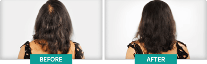 BioGrow RX Customer ~Kerry P.